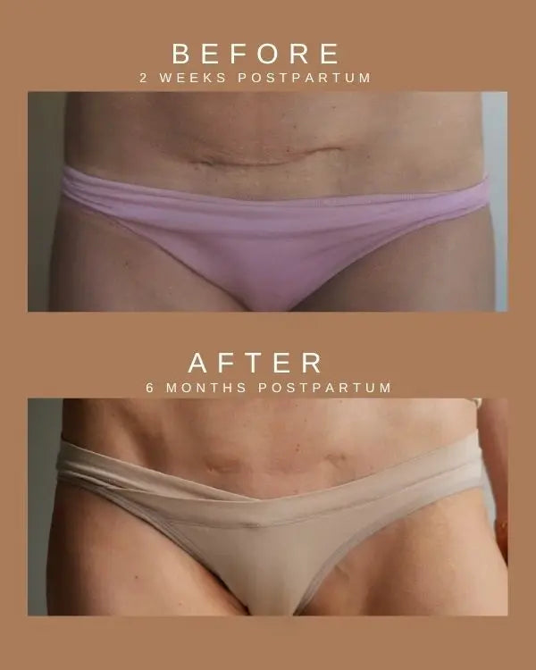 Nemah ~ Restorative Scar Treatment