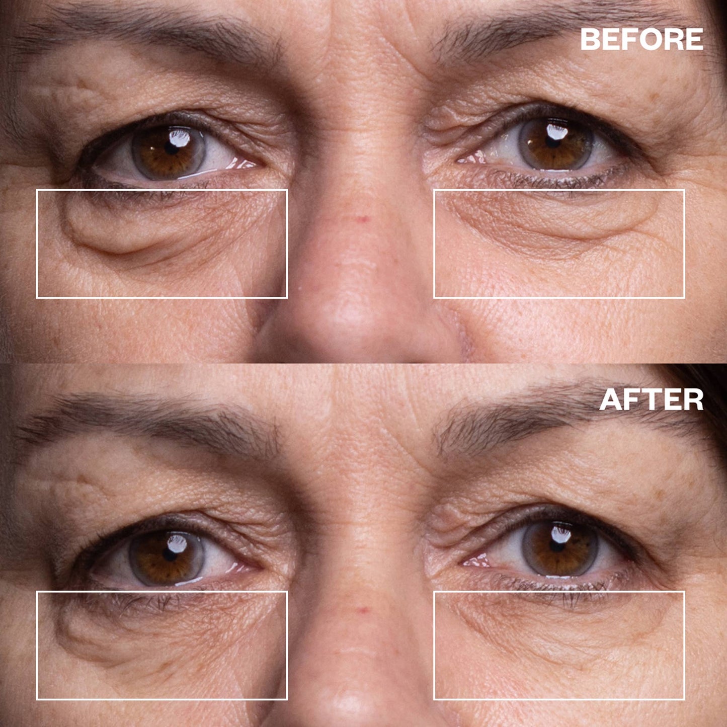 Eye Wrinkle Patches