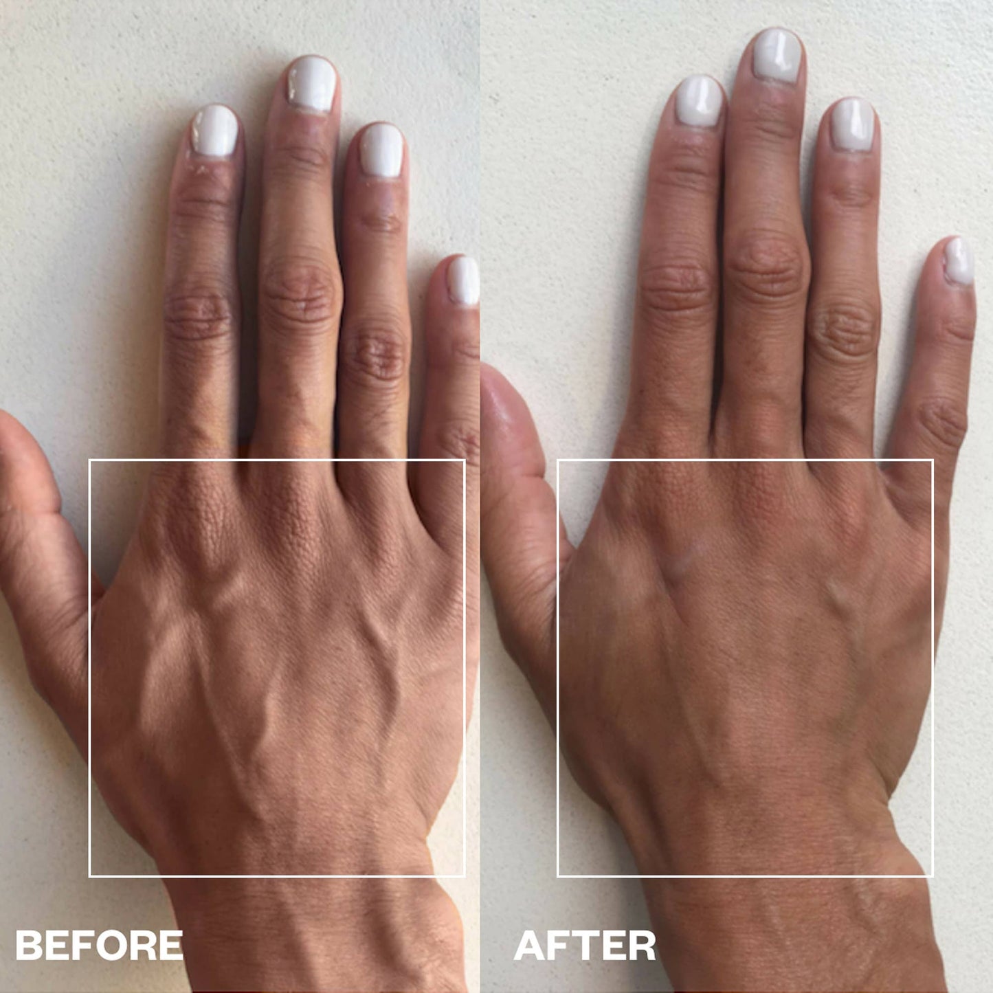 Hand Wrinkle Patches