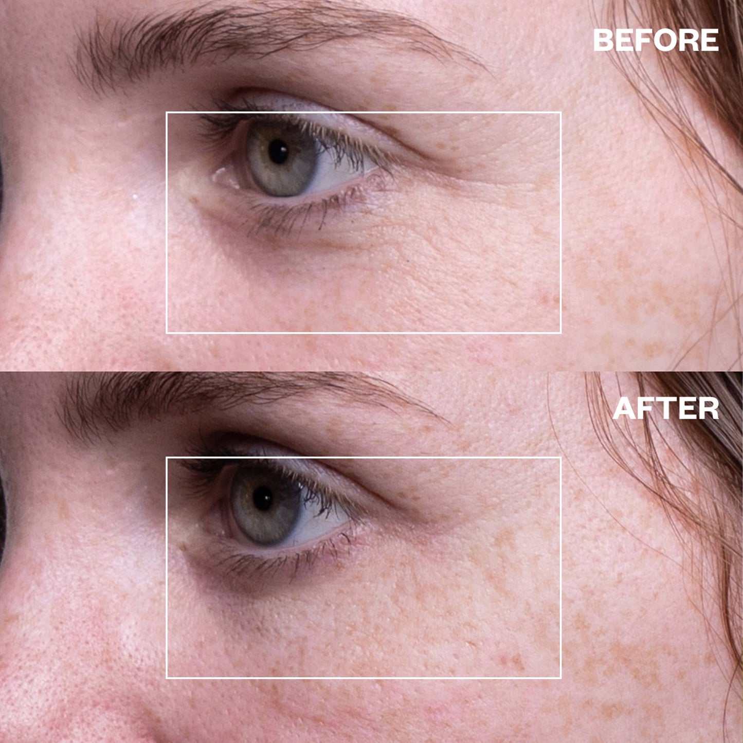 Eye Wrinkle Patches